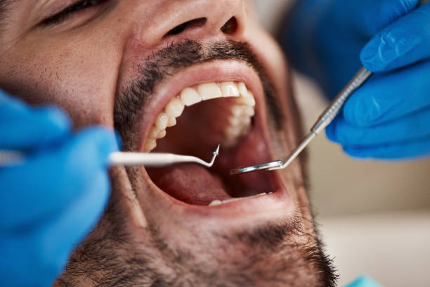 Best Emergency Denture Repair in Fort Irwin, CA